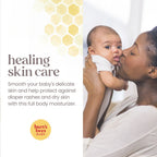Baby Multipurpose Ointment